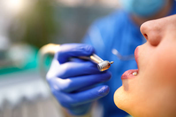 Dental Inlays and Onlays in Rancho Cucamonga, CA